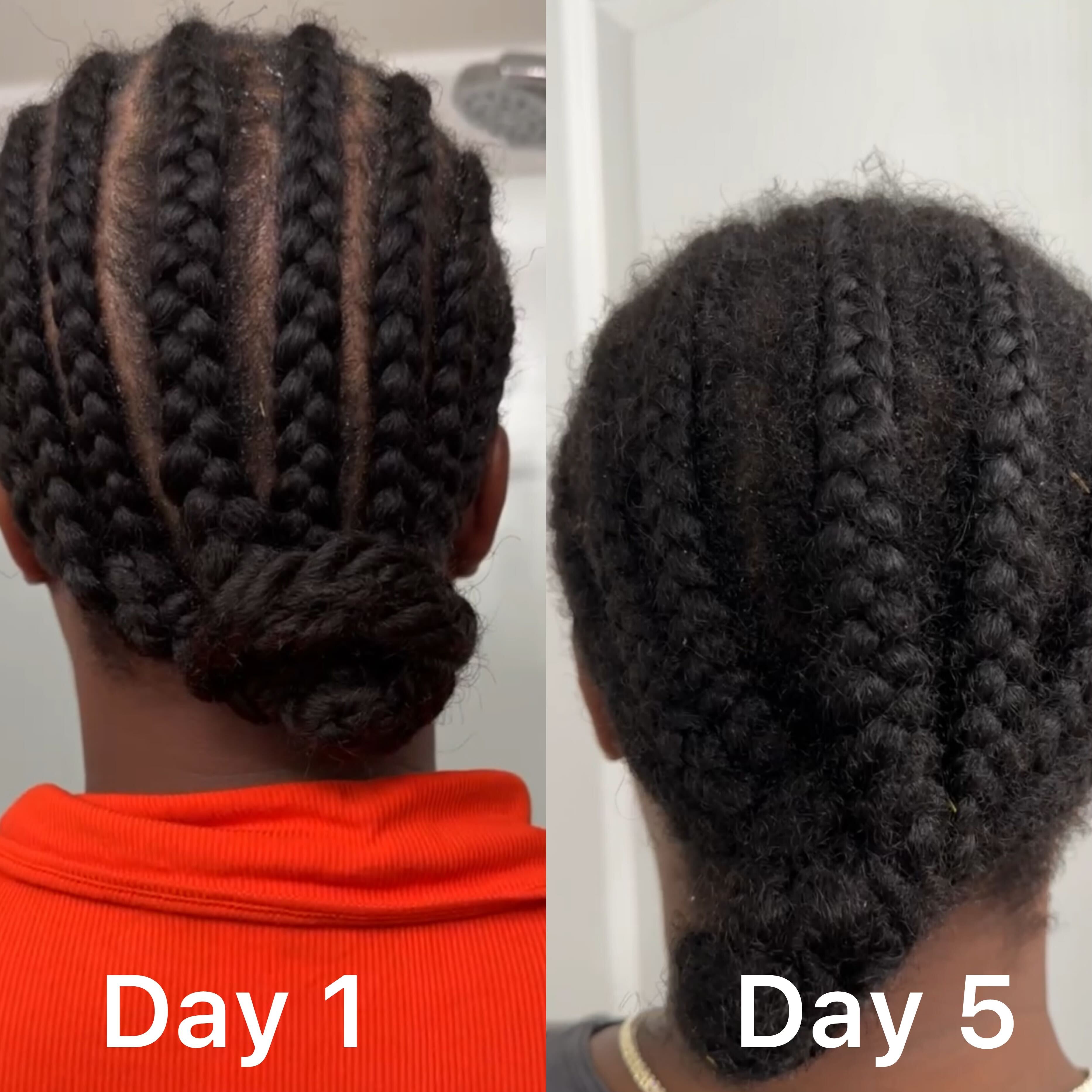 Do you suffer from Hairloss?? Understanding and Preventing Hair Loss 🌱💇♂️