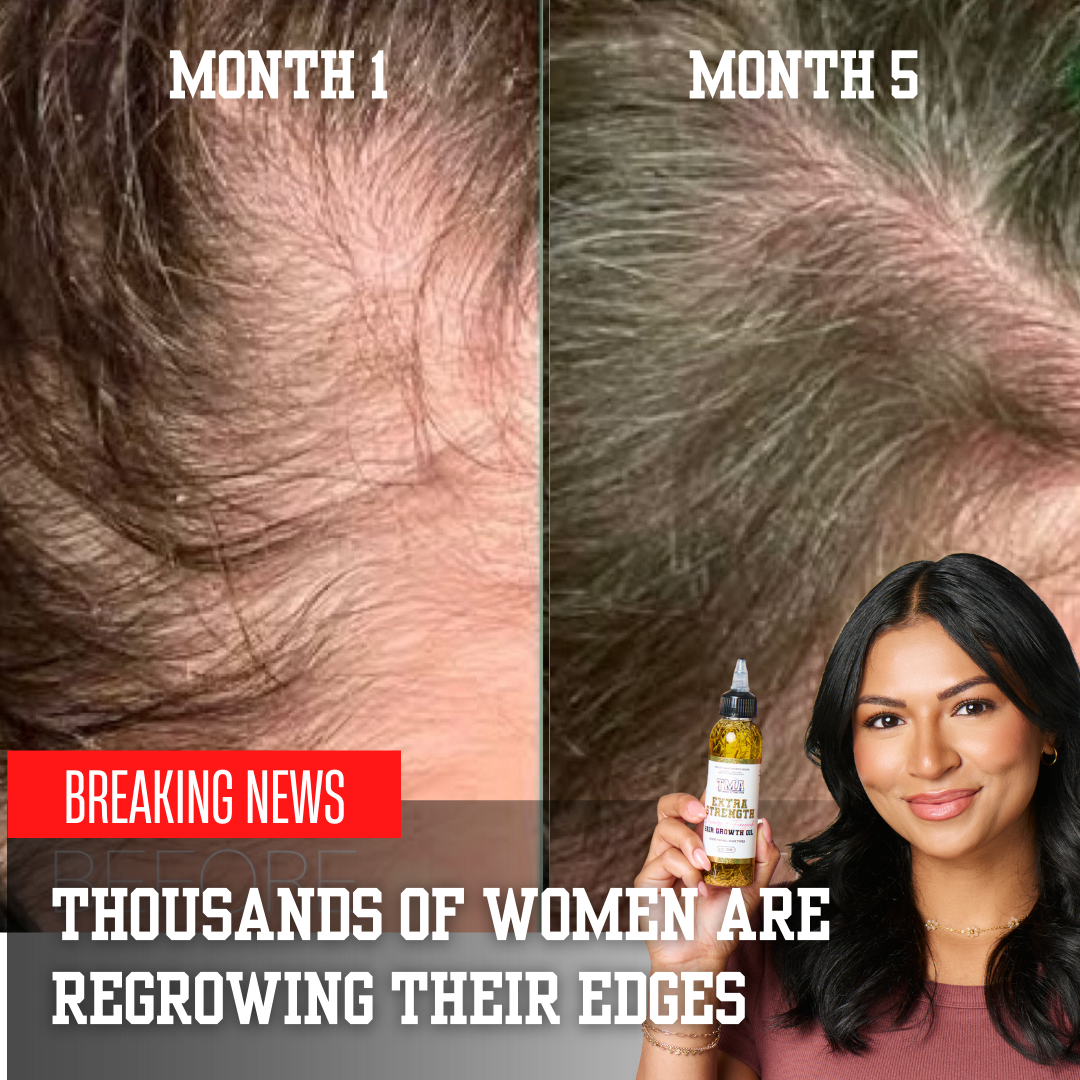 Jumbo Extra Strength Rosemary+Fenugreek Herbal Hair Growth Oil - The Mane Attraction