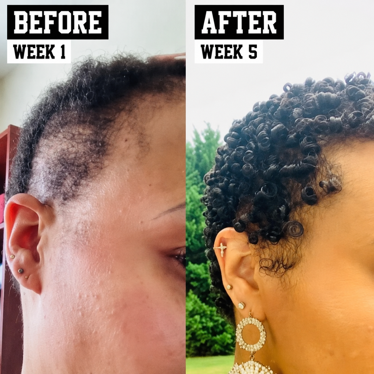 Daily Hair Growth Moisture Mist - The Mane Attraction