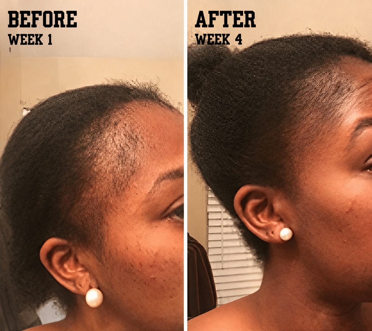 Length Retention & Growth System - The Mane Attraction