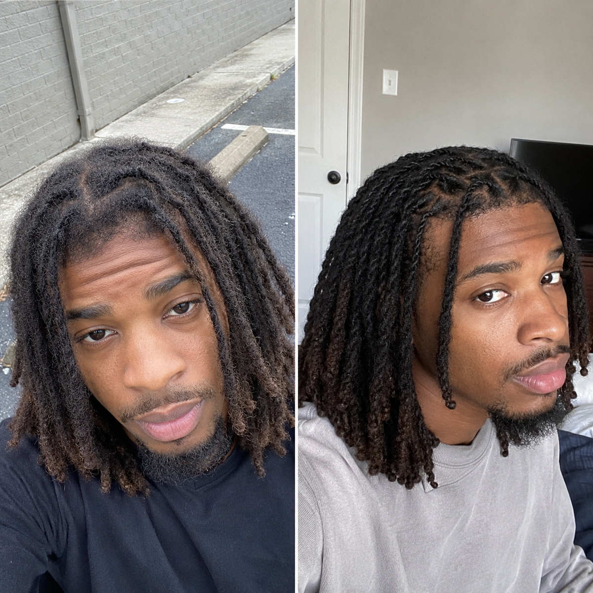 Complete Beard & Scalp Growth System - The Mane Attraction