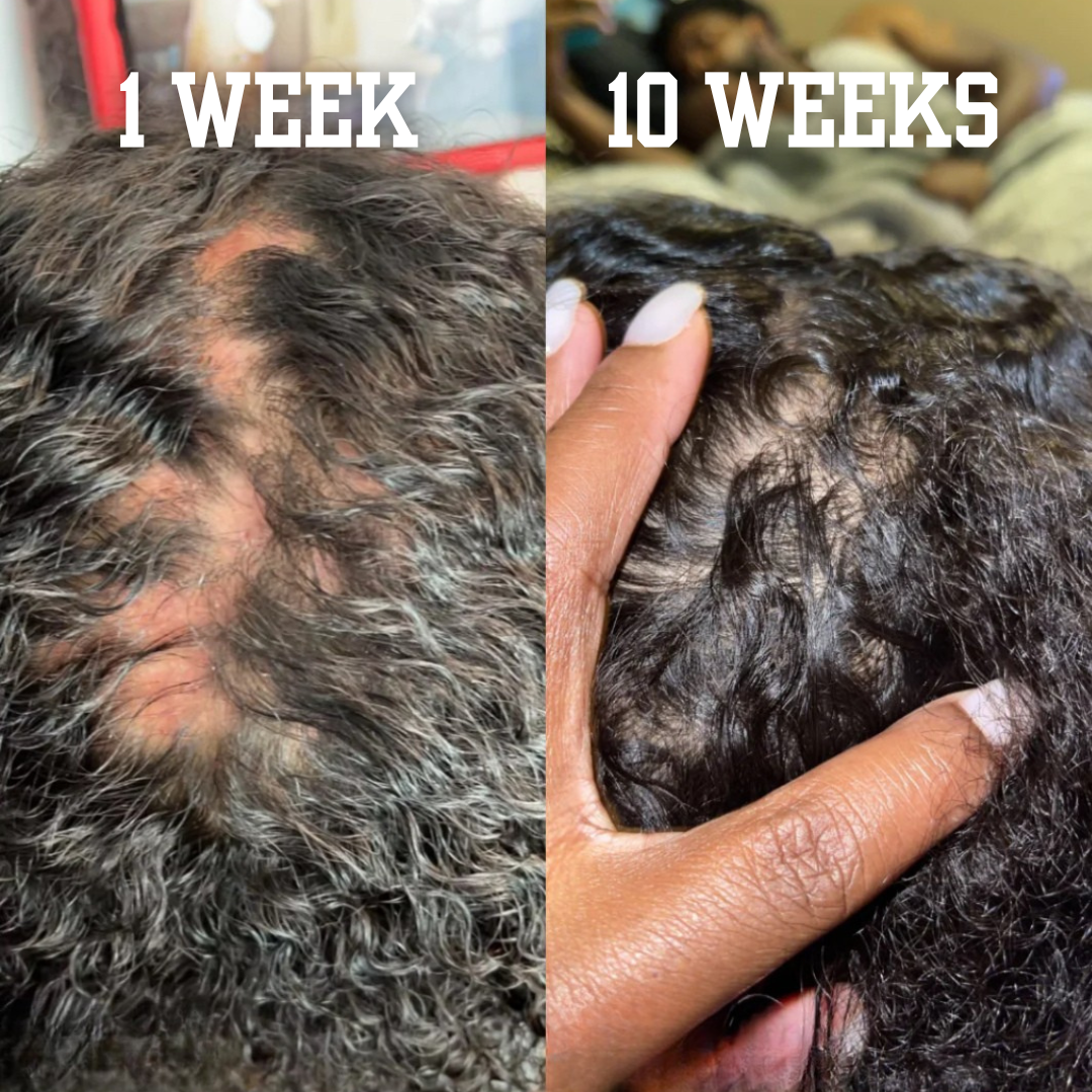 Length Retention & Growth System - The Mane Attraction