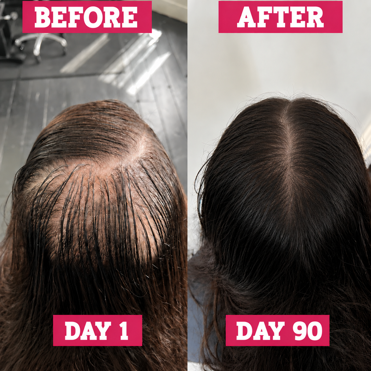 biotin gummies - The Mane Attraction