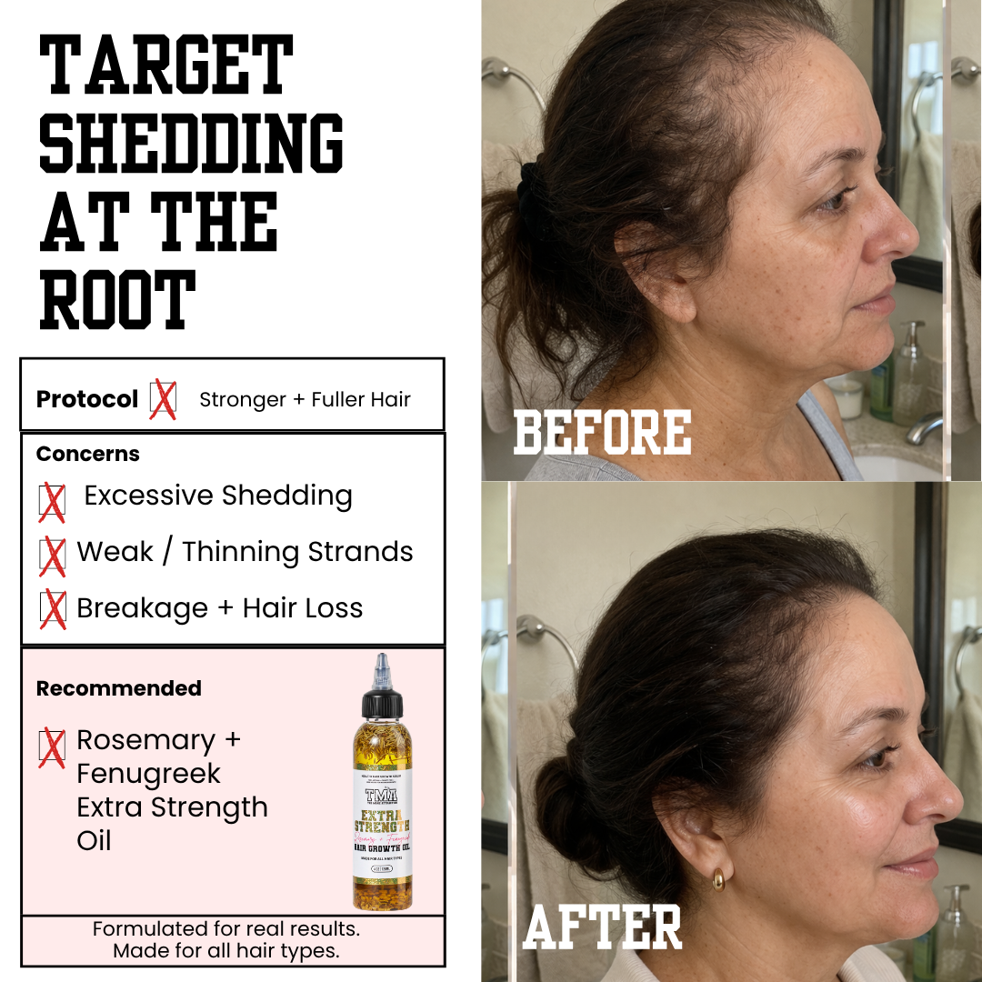 Jumbo Extra Strength Rosemary+Fenugreek Herbal Hair Growth Oil - The Mane Attraction