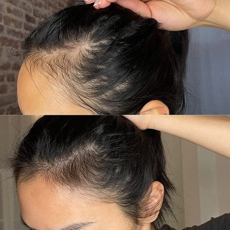Jumbo Stimulating Hair Growth Oil - The Mane Attraction