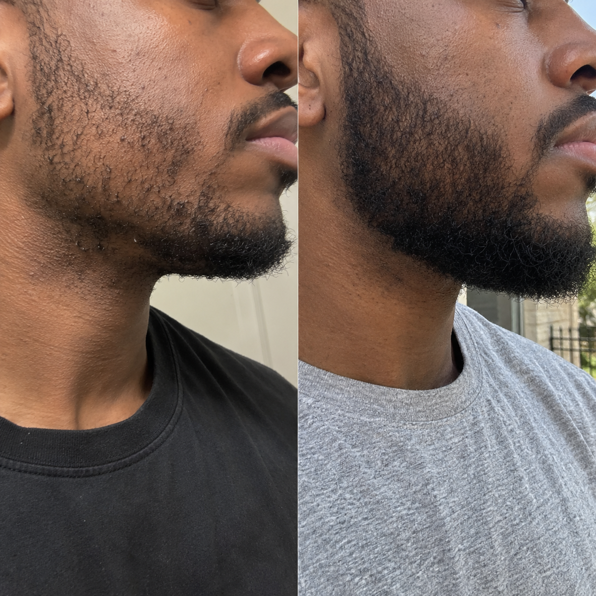 Complete Beard & Scalp Growth System - The Mane Attraction