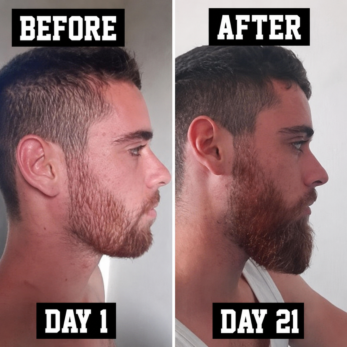 Jumbo Beard & Scalp Stimulating Growth Oil 3-In-1 Bundle - The Mane Attraction