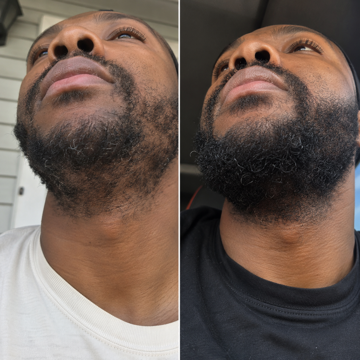 Beard & Scalp Growth Trio - The Mane Attraction
