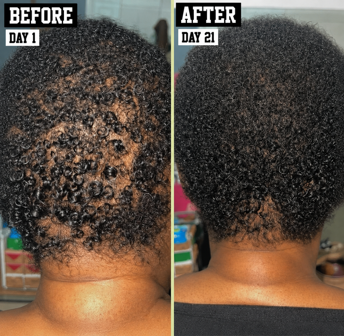 Jumbo Stimulating Hair Growth Oil - The Mane Attraction