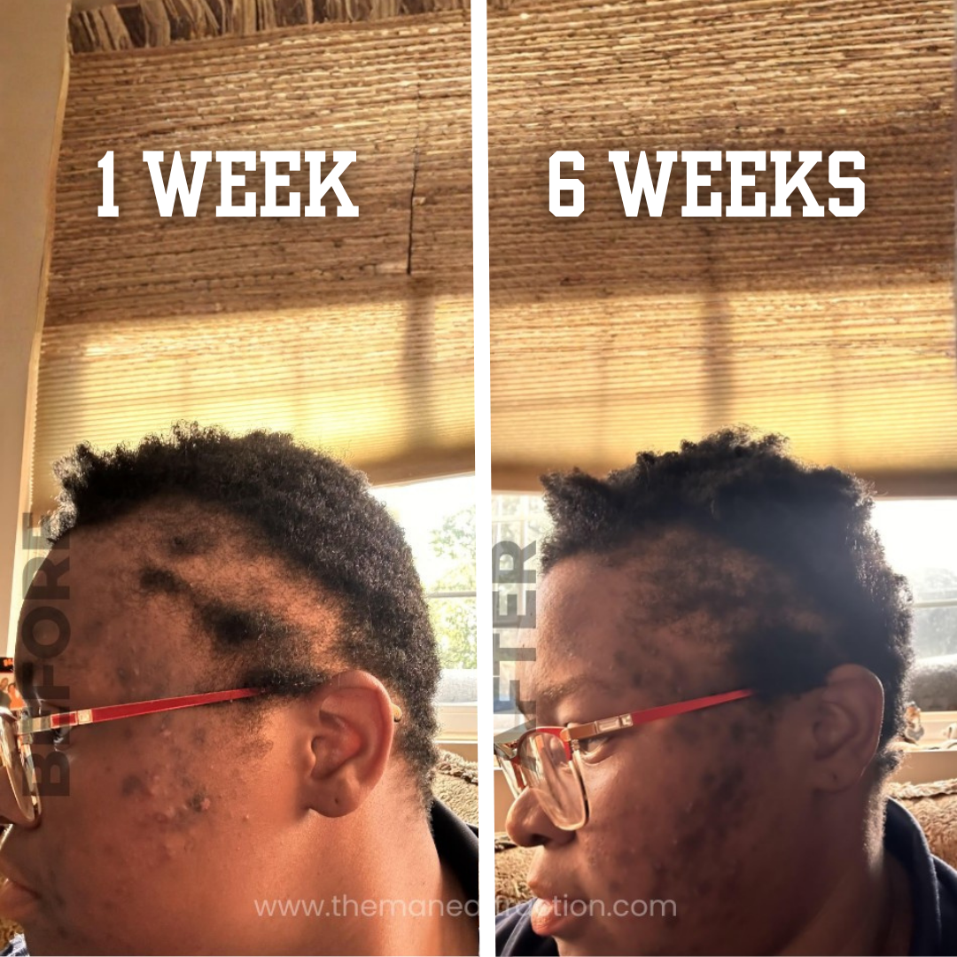 Jumbo Extra Strength Rosemary+Fenugreek Herbal Hair Growth Oil - The Mane Attraction