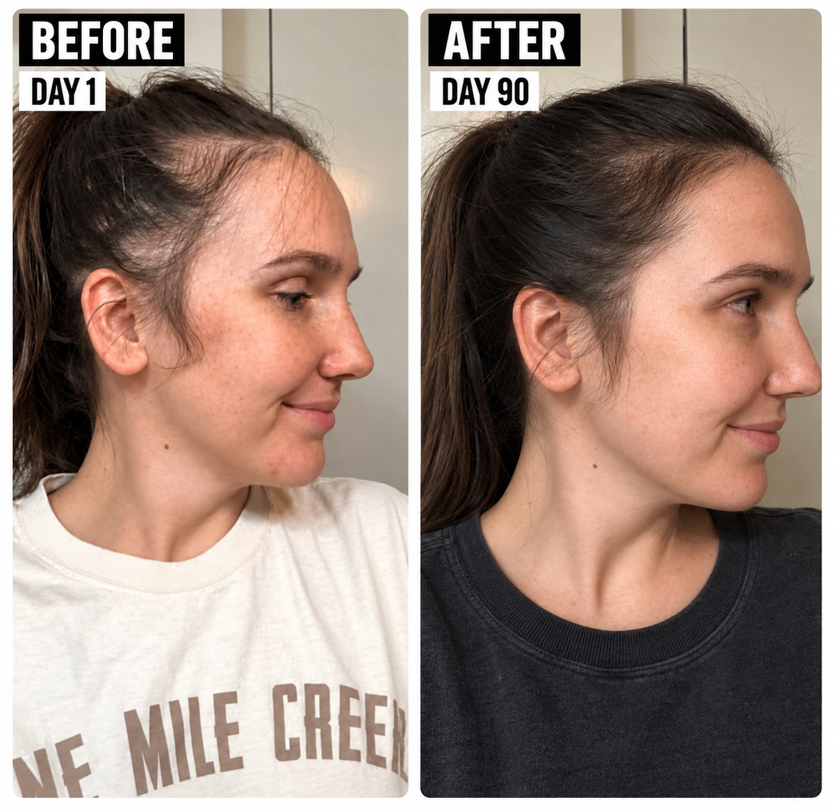 Jumbo Extra Strength Rosemary+Fenugreek Herbal Hair Growth Oil - The Mane Attraction