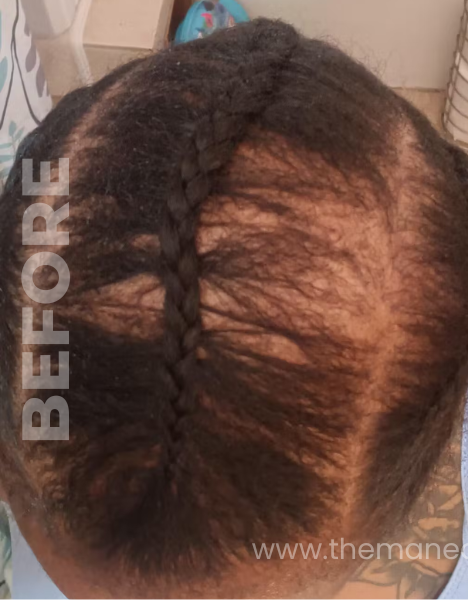 BEFORE