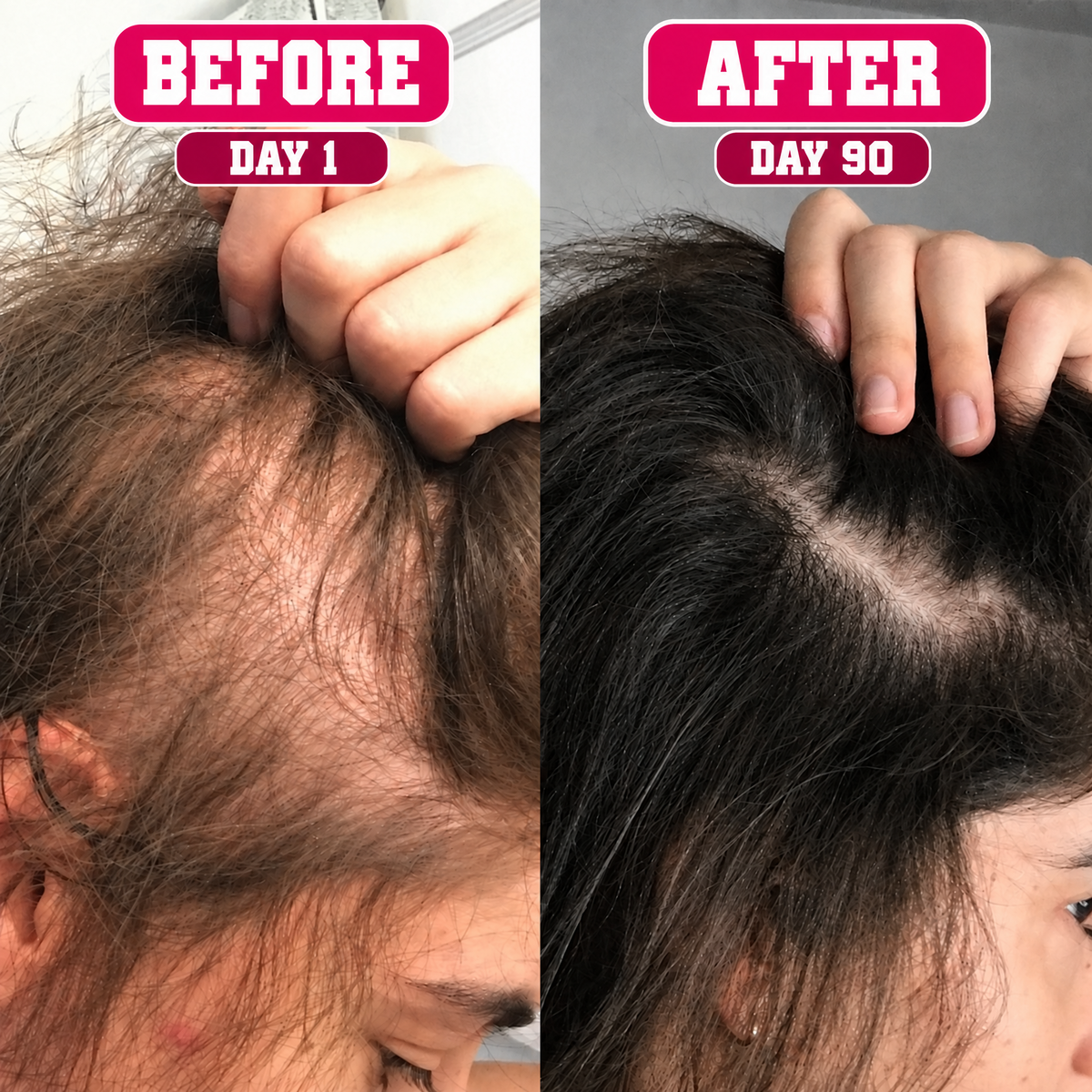 biotin gummies - The Mane Attraction