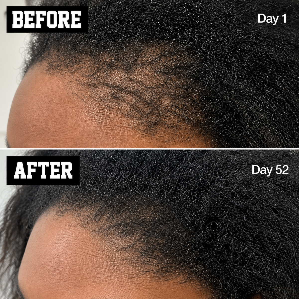 Daily Hair Growth Duo - The Mane Attraction