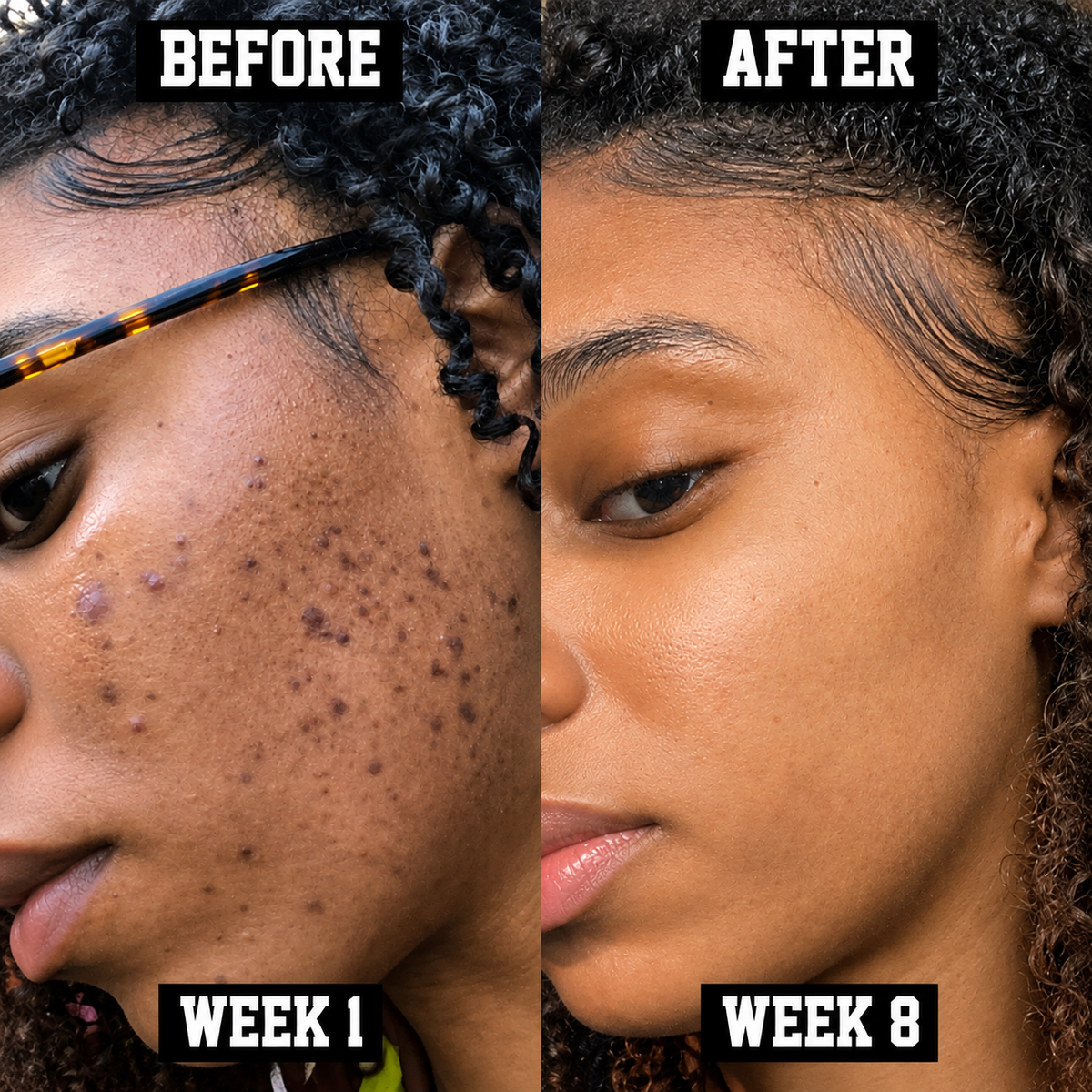Facial Cleanse+Hydrate Bundle - The Mane Attraction